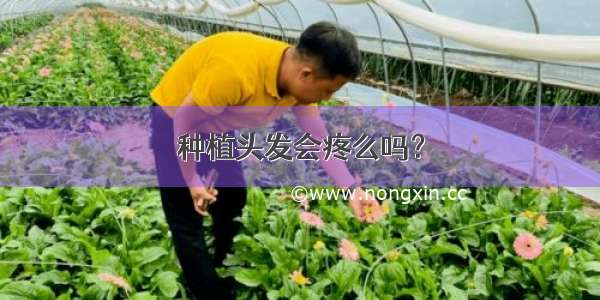 种植头发会疼么吗？