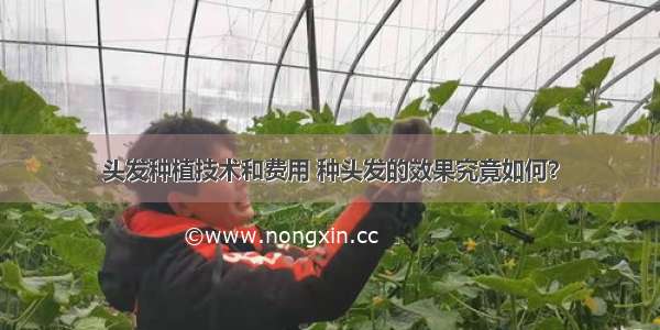 头发种植技术和费用 种头发的效果究竟如何？